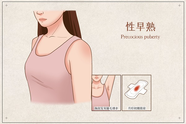 西安儿童性早熟哪家医院比较好：女孩性早熟怎么办?家长应了解的7个应对措施